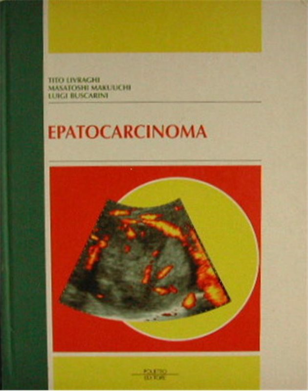 EPATOCARCINOMA